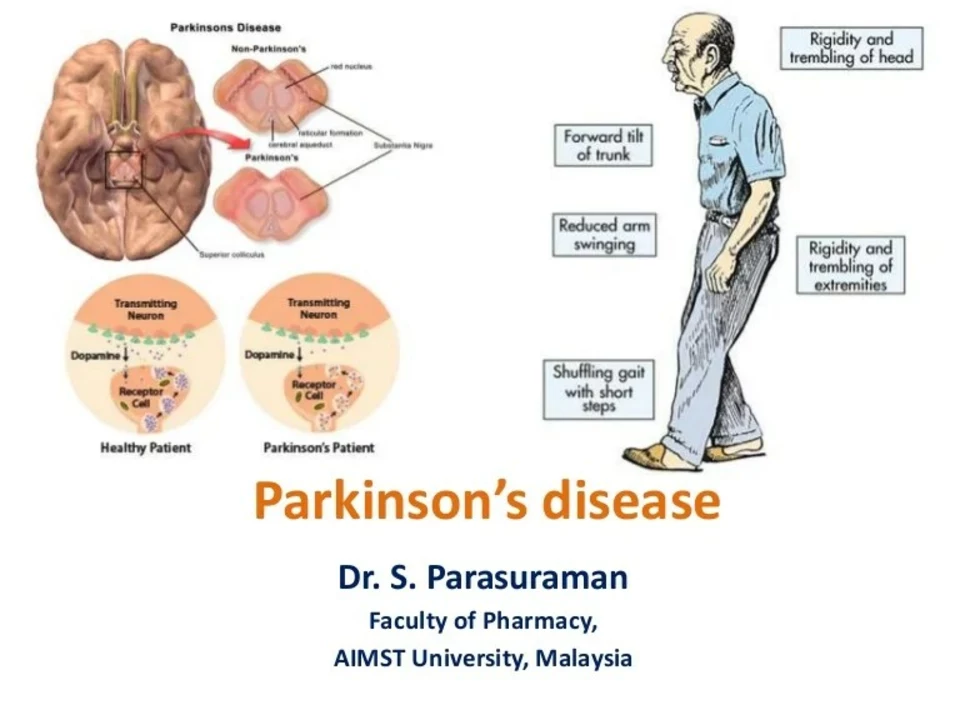 The use of Amantadine in combination with other medications for Parkinson's disease