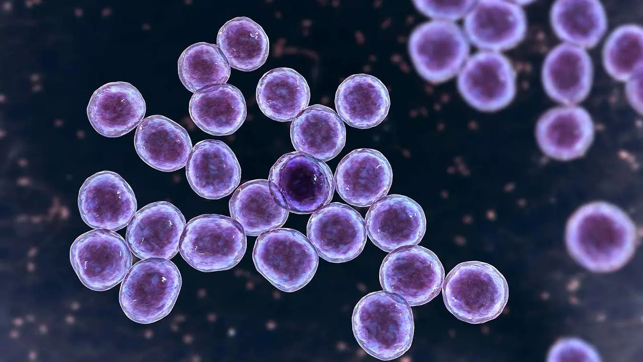 The role of mupirocin in treating methicillin-resistant Staphylococcus aureus (MRSA)